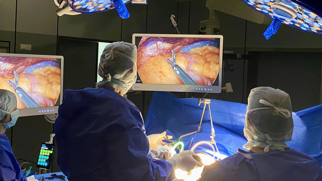 VIRON-X-camera-system-visualization-of-fluorescence-overview-OP The VIRON X camera system is designed for demanding applications: Impressive image quality in 4K and visualization of fluorescence offer a wide range of possibilities, especially in laparoscopy.